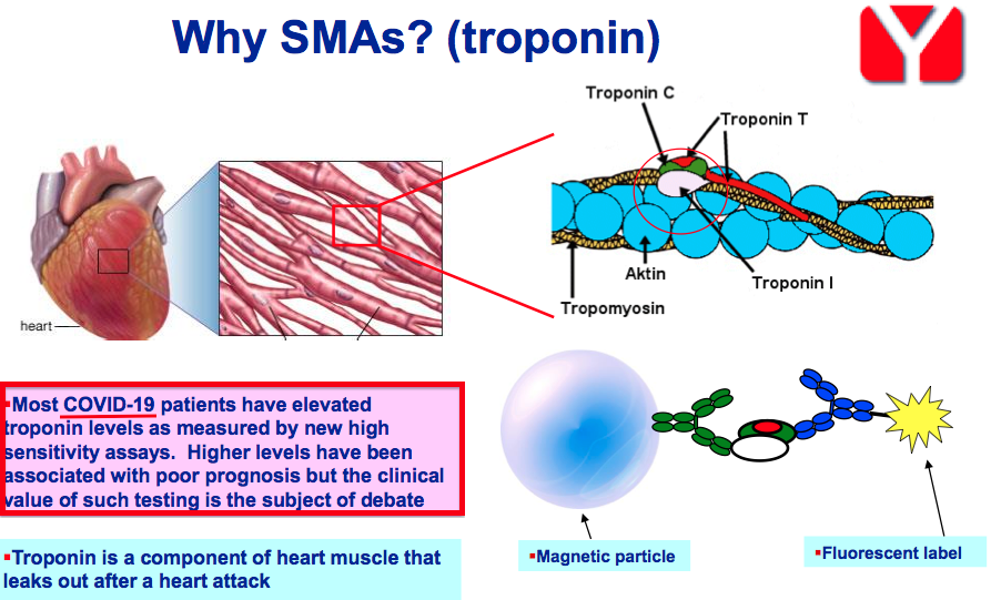 bvxp bioventix h1 2020 results troponin slide